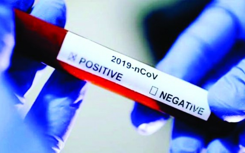 Prefeitura recebe kits de testes rápidos do Coronavírus